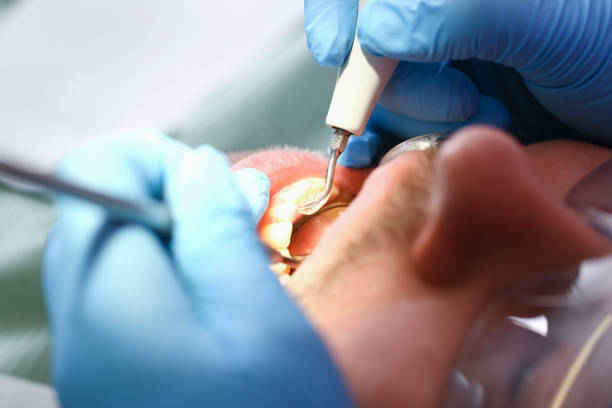 Best Tooth Infection Emergency Dentist  in Burkburnett, TX